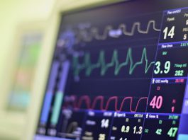 مانیتور علائم حیاتی