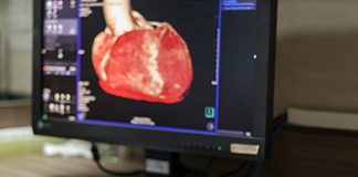 سی تی آنژيوگرافی