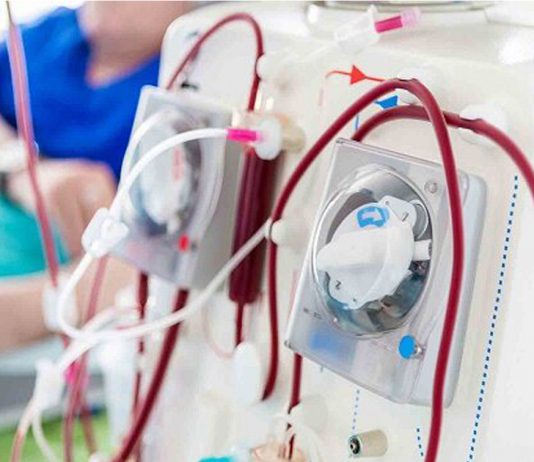 دستگاه دیالیز