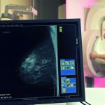 ماموگرافی (mammography)