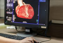 سی تی آنژيوگرافی