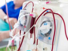 دستگاه دیالیز