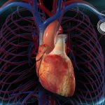 انواع پیس میکر